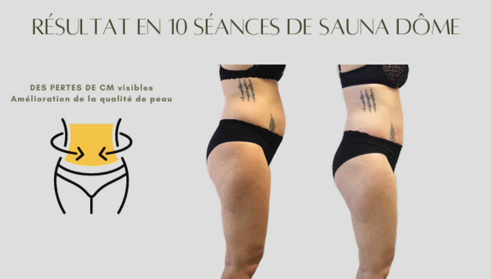 Avant / Après Sauna Dôme