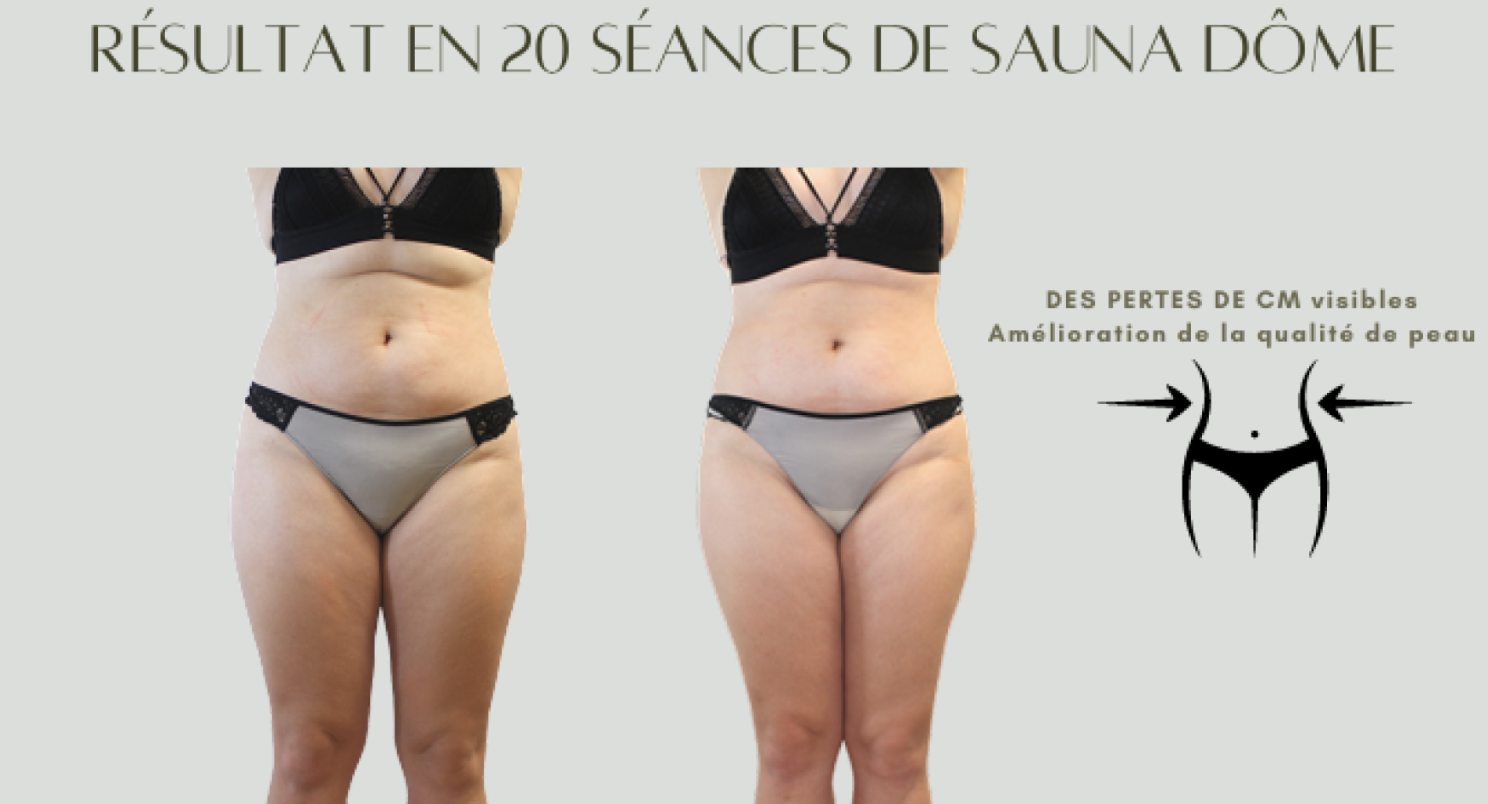 Avant / Après Sauna Dôme 1