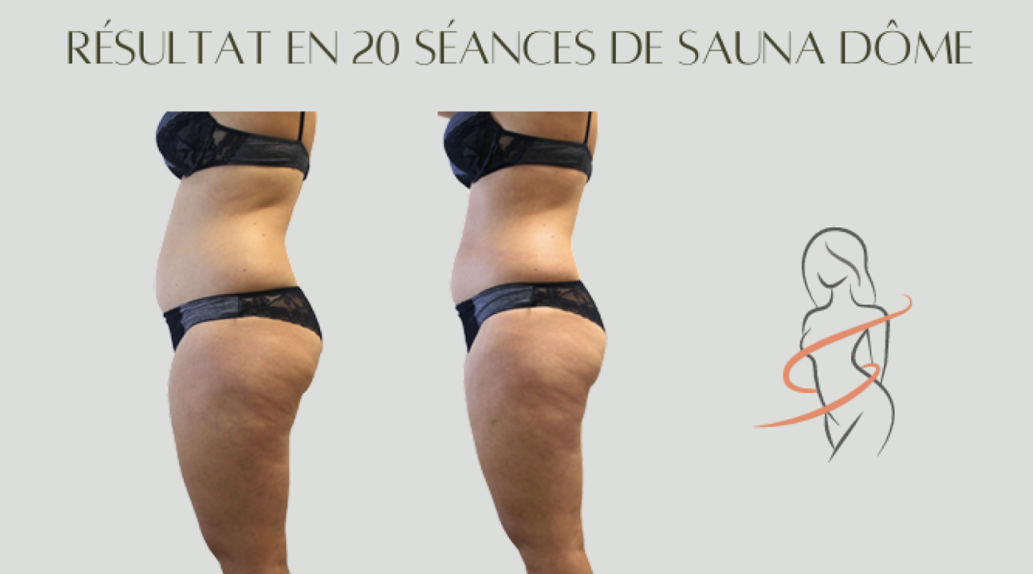 Avant / Après Sauna Dôme 3