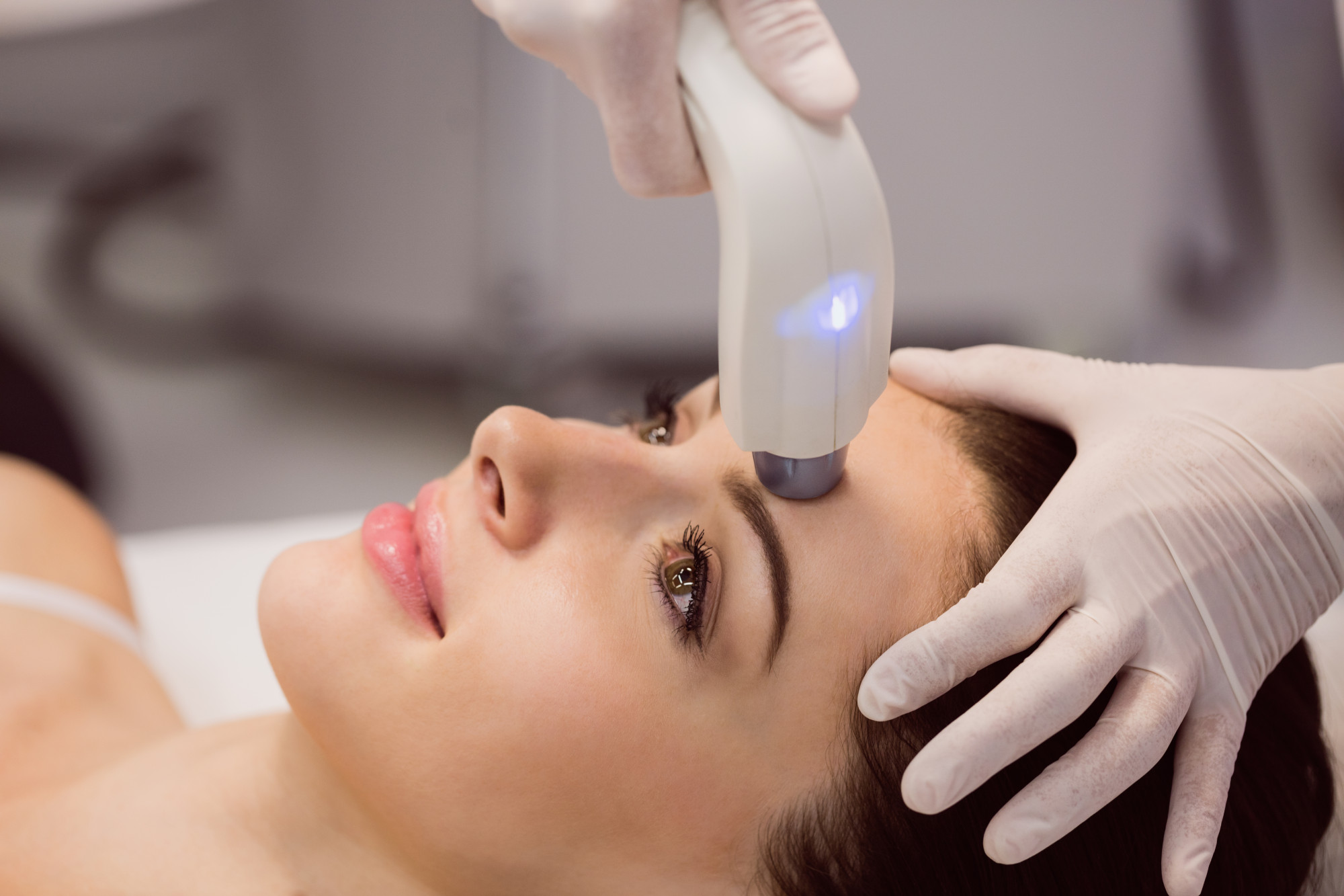 Épilation laser femme