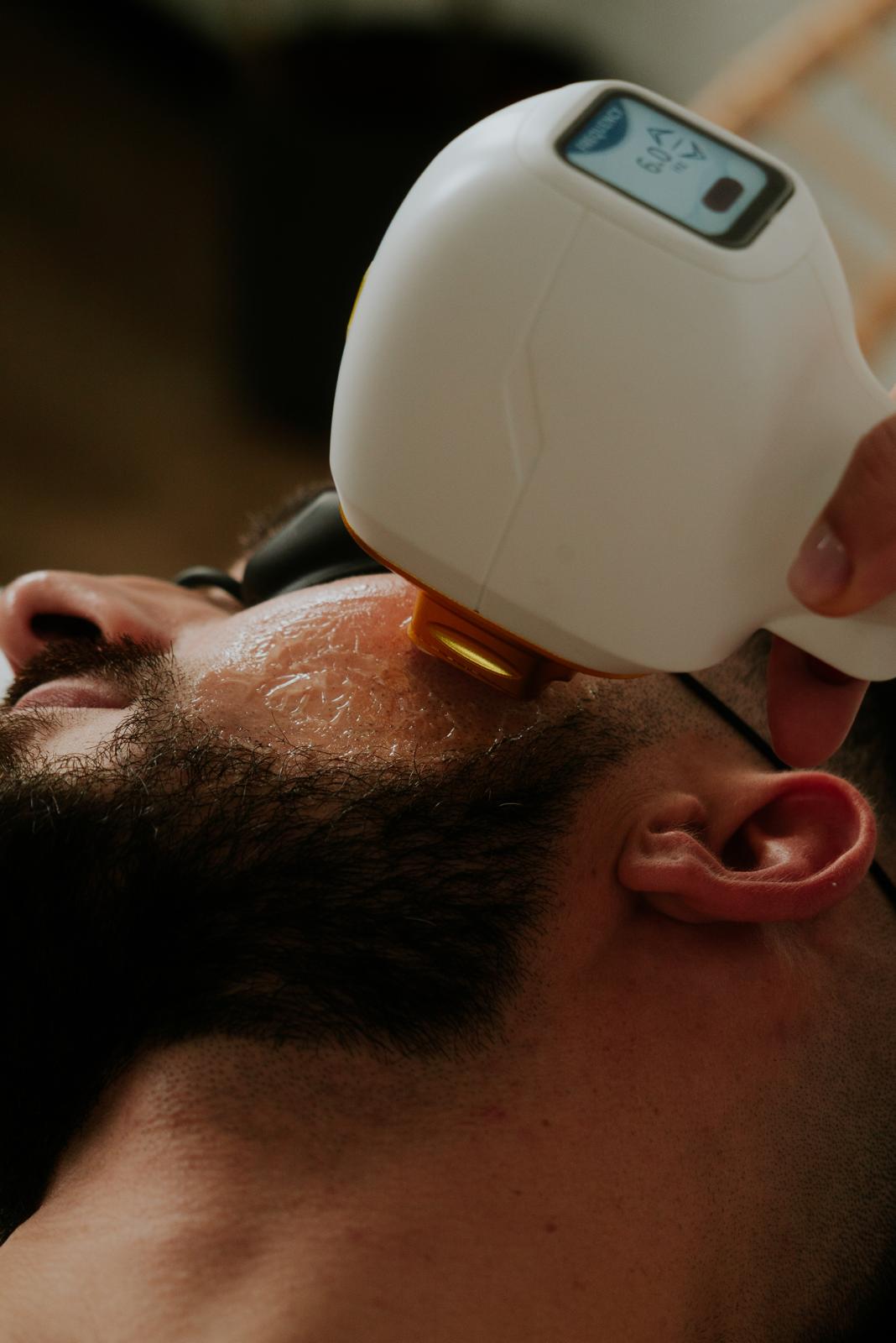 Épilation laser homme