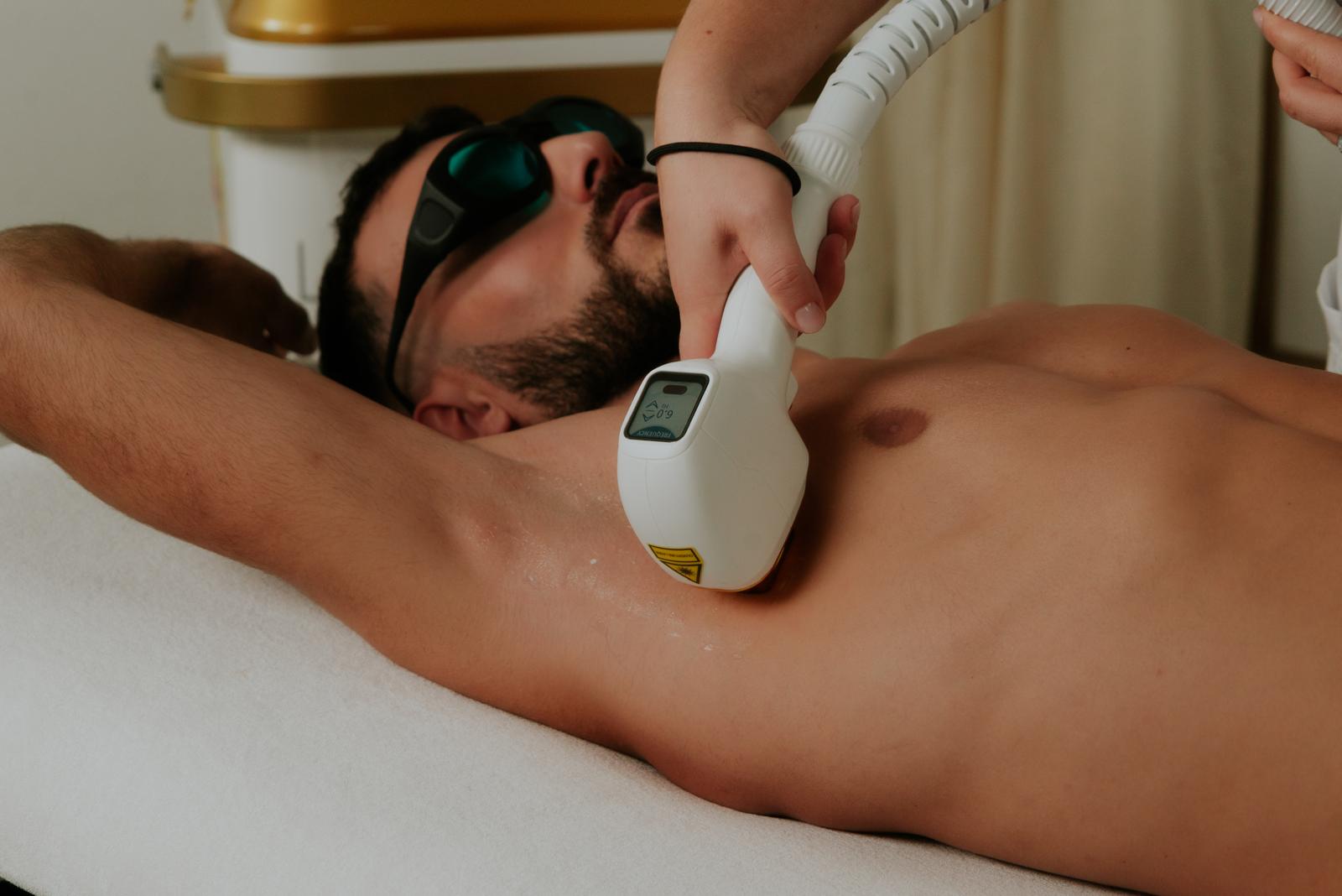 Résultat épilation homme