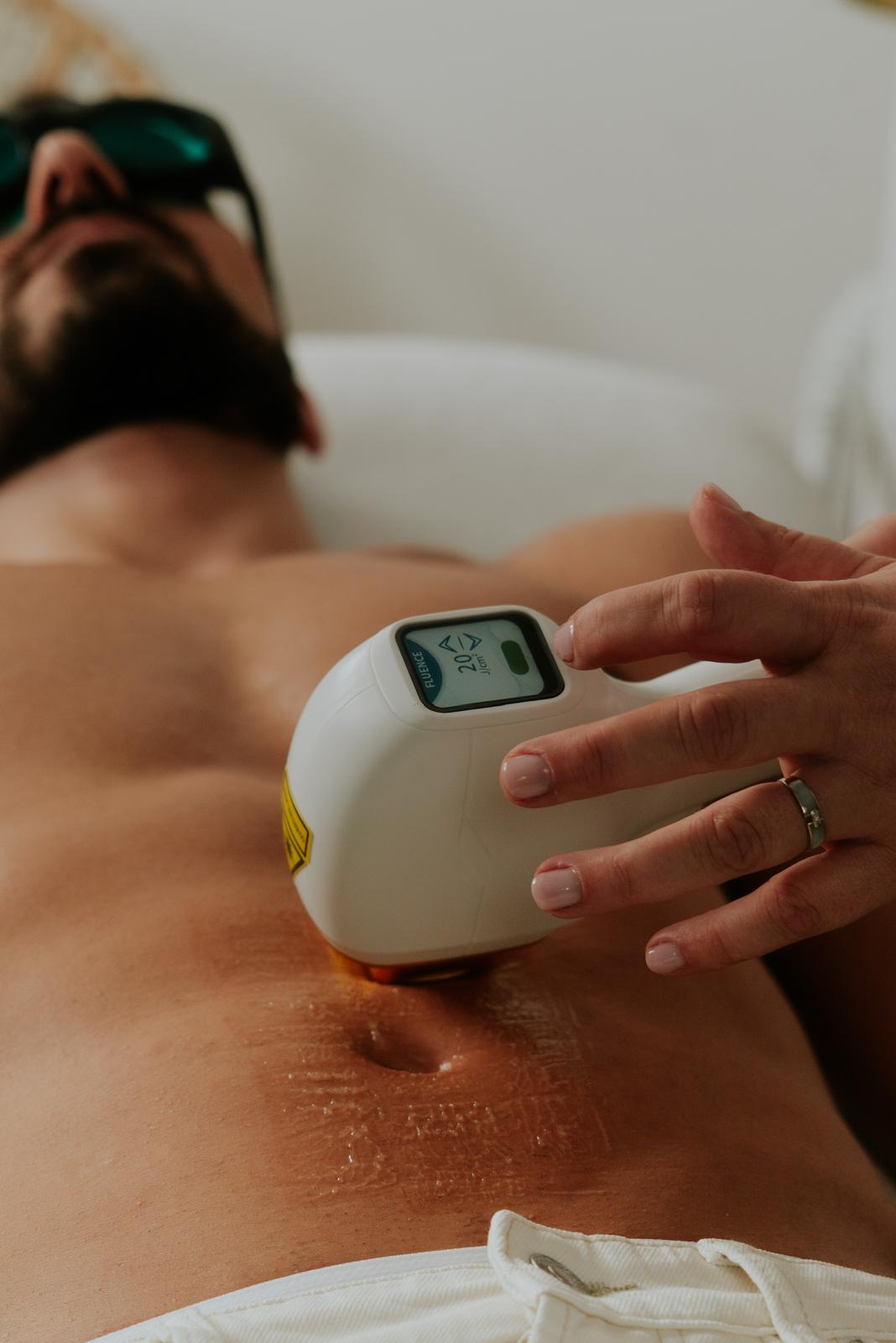 Appareil d'épilation laser